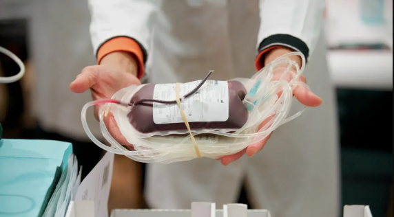 Understanding Blood Filters in Safe Transfusion Practices